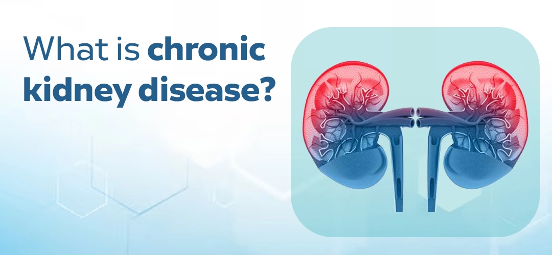 Mnemonic For Drugs To Avoid In Renal Failure (AKI And CKD), 49% OFF